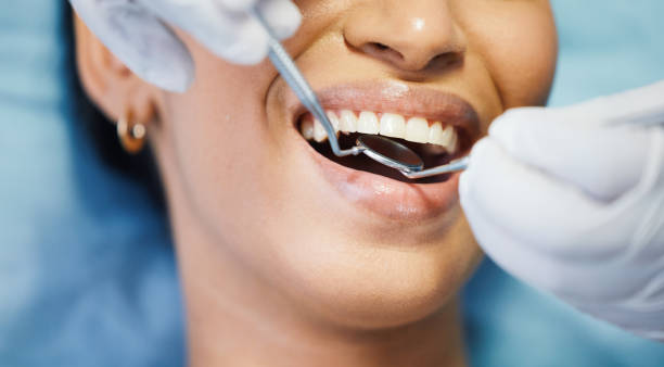 Best Emergency Root Canal Treatment in Adair Village, OR